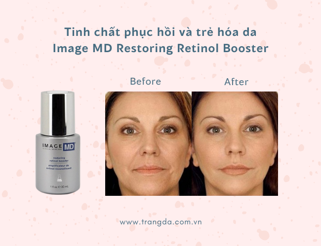 Hiệu quả của Tinh chất phục hồi và trẻ hóa da Image MD Restoring Retinol Booster