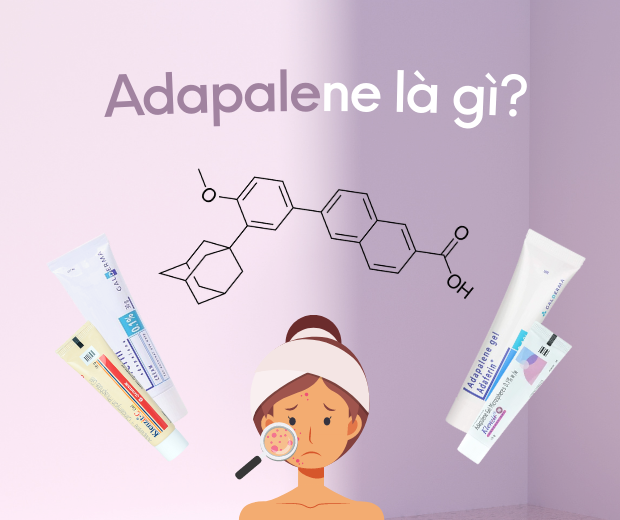 Adapalene là gì? Công dụng trị mụn và cách dùng sao cho hiệu quả