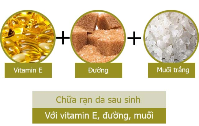 trị rạn da sau sinh