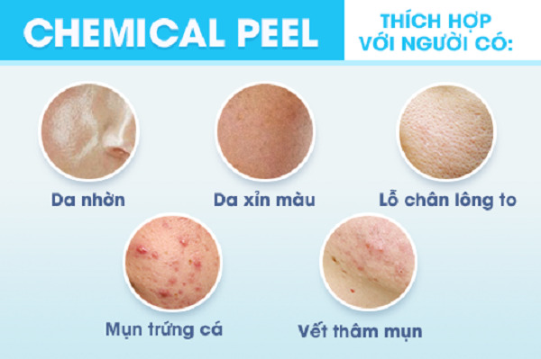Những loại da có thể thực hiện peel da được các chuyên gia hàng đầu kiếm chứng