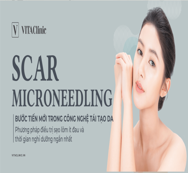 Scar Microneedling - Bước tiến mới trong công nghệ tái tạo da