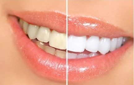 Sức khỏe răng miệng - Ảnh 5