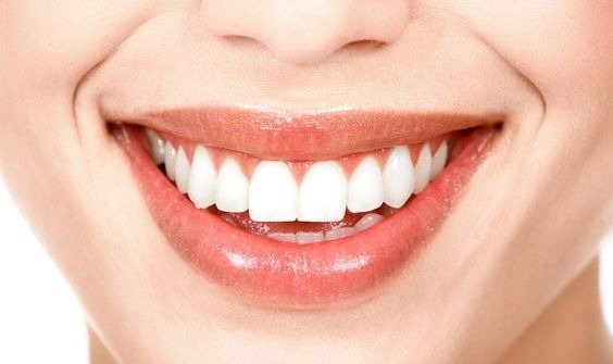 Niềng răng 1 hàm là gì? Giá bao nhiêu?