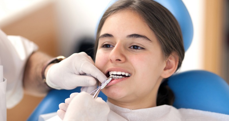 Lời khuyên hữu ích dành cho người niềng răng thẩm mỹ - Ảnh 4