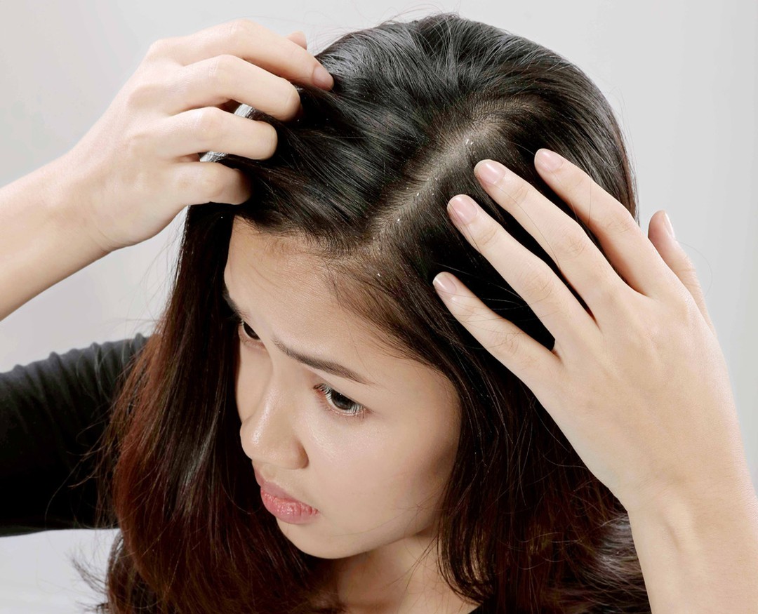 12 Cách trị rụng tóc sau sinh tại nhà hiệu quả và kích thích tóc mọc lại sau sinh