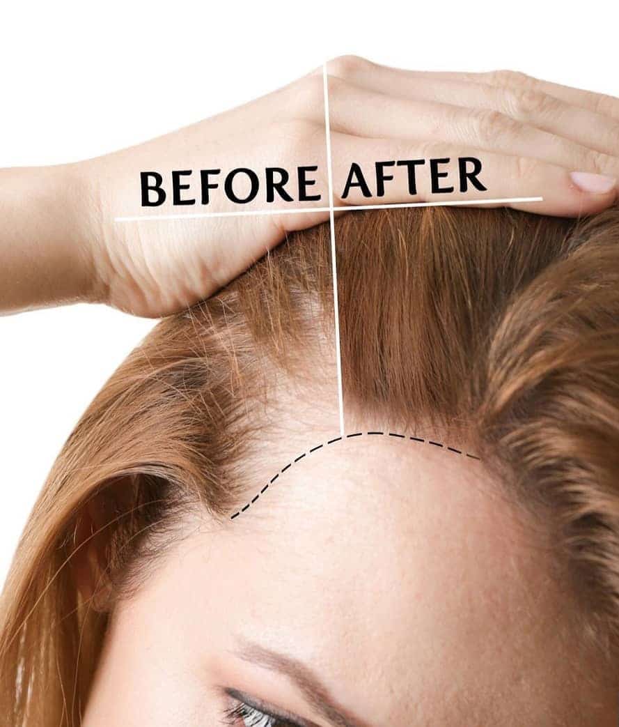 3 cách chữa rụng tóc cực hiệu quả bạn cần biết ngay