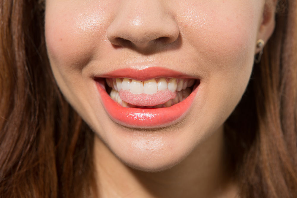 Hàm răng trắng sáng và 6 lợi ích đi kèm có thể bạn chưa biết