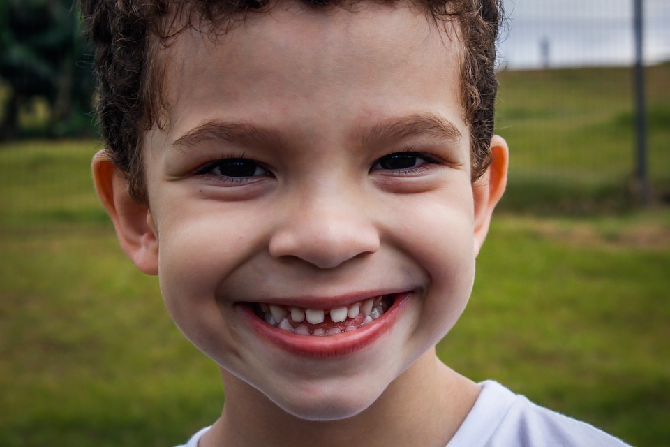 Thời gian niềng răng hàm trên đối với trẻ em - Ảnh 2