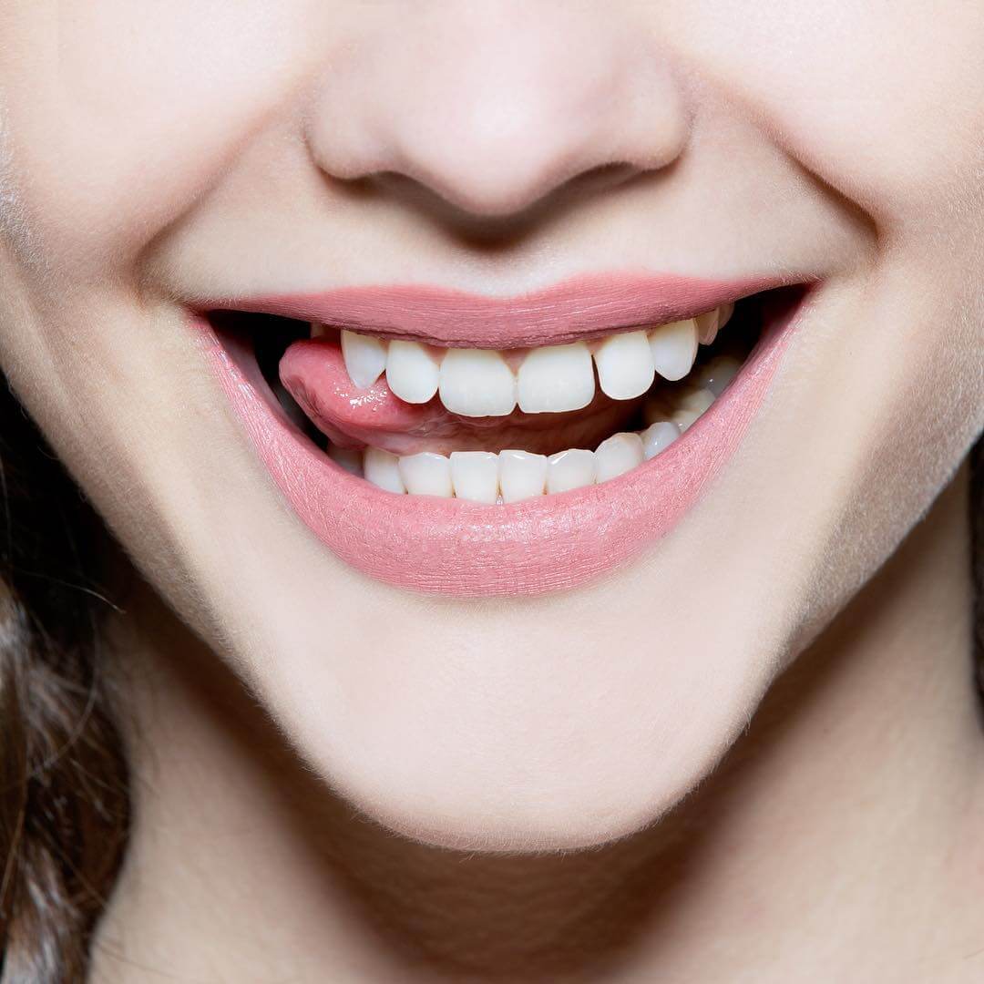 3 lí do bạn nên chọn miếng dán trắng răng cho một hàm răng chuẩn "celeb"