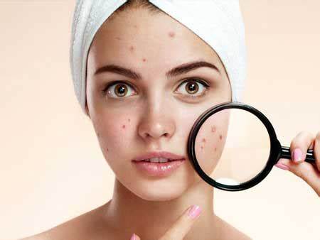 6 bước skincare cho da dầu mụn cơ bản vào buổi tối