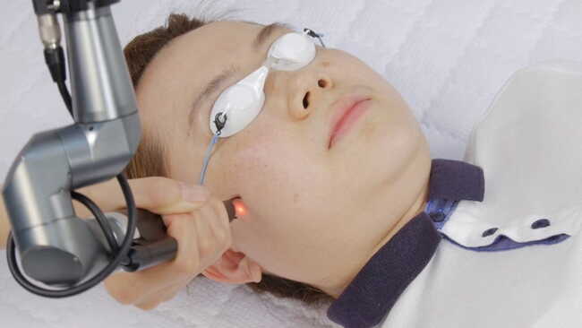 Công nghệ Laser đã được kiểm định bởi FDA giúp điều trị mụn hiệu quả