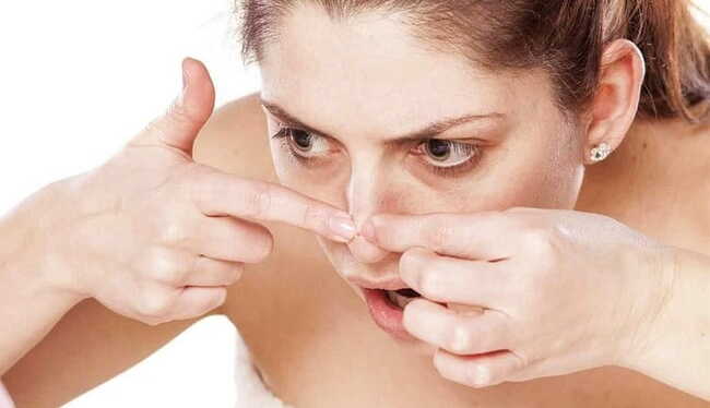 Dùng tay nặn mụn tiềm ẩn nhiều nguy cơ nhiễm trùng làn da