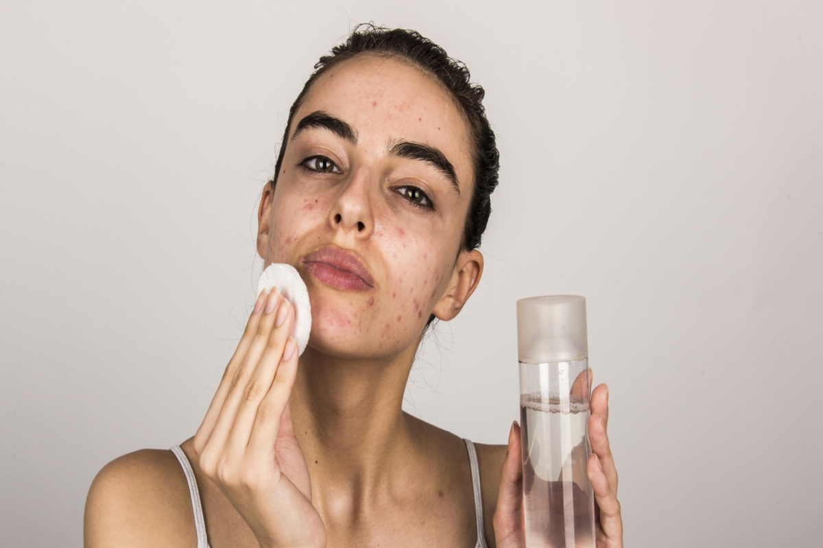 Cách chăm sóc da dầu mụn hàng ngày với 8 bước đơn giản