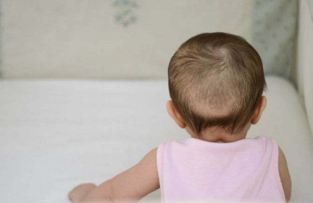 Cách chữa rụng tóc vành khăn ở trẻ sơ sinh và trẻ nhỏ