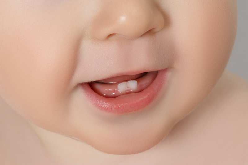 Trẻ mấy tháng mọc răng? Dấu hiệu bé mọc răng và cách chăm sóc