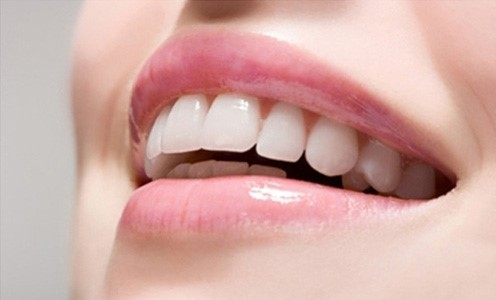 <strong>Tại sao có hàm răng đẹp hoàn hảo lại quan trọng đối với chúng ta?</strong>