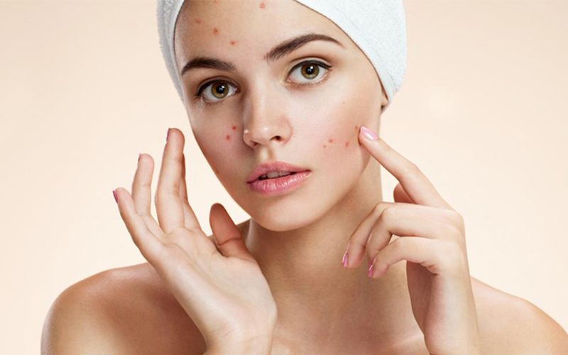 Kích ứng da thường xuất hiện những mẩn đỏ, sưng tấy nhưng phạm vi ảnh hưởng nhẹ hơn so với dị ứng da