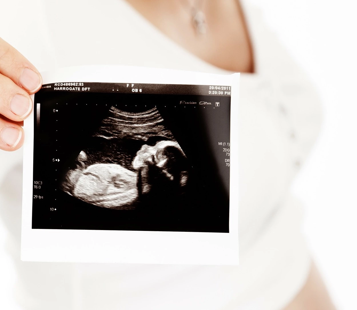 Tầm quan trọng của siêu âm đối với việc theo dõi các chỉ số của thai nhi