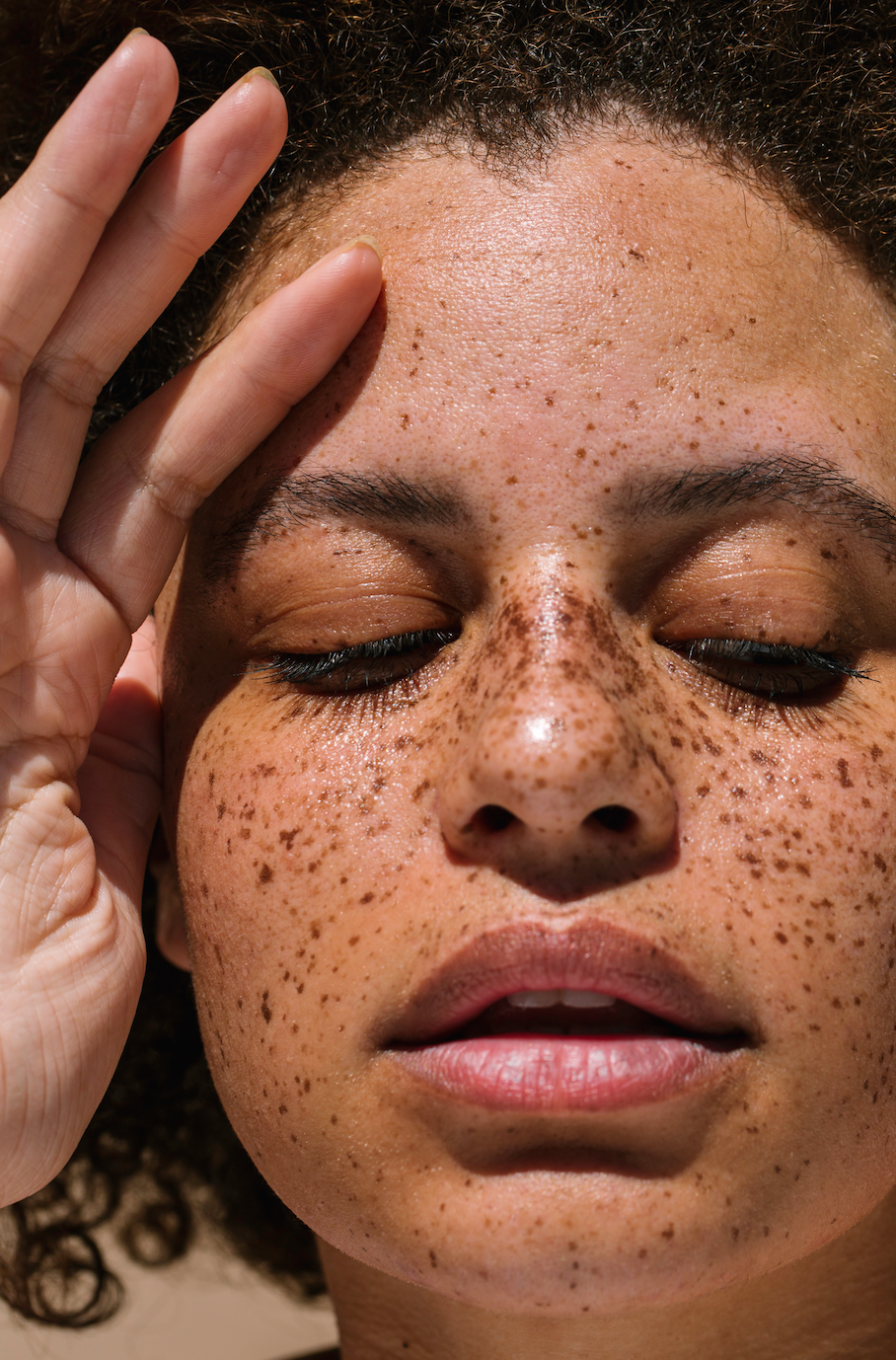 3 nguyên nhân gây nám da phổ biến ở phụ nữ