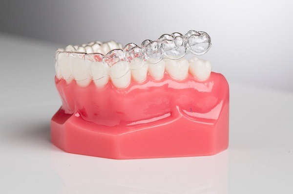 Các vấn đề tiềm ẩn với phương pháp niềng răng hàm dưới là gì?