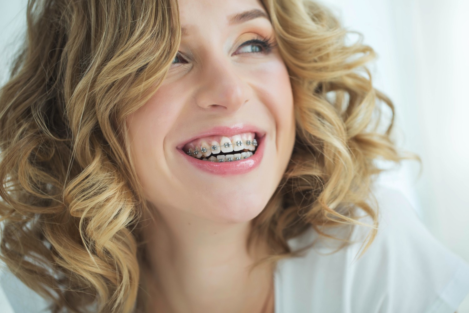 Các giai đoạn niềng răng diễn ra thế nào?
