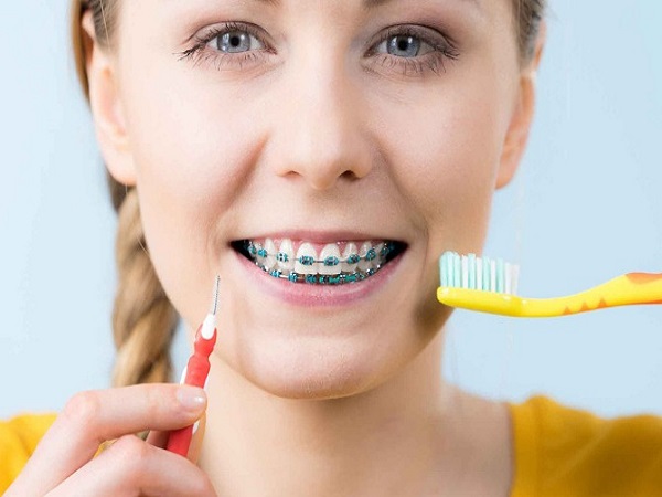 Cách chăm sóc răng miệng khi niềng răng bằng bàn chải đánh răng - Ảnh 1