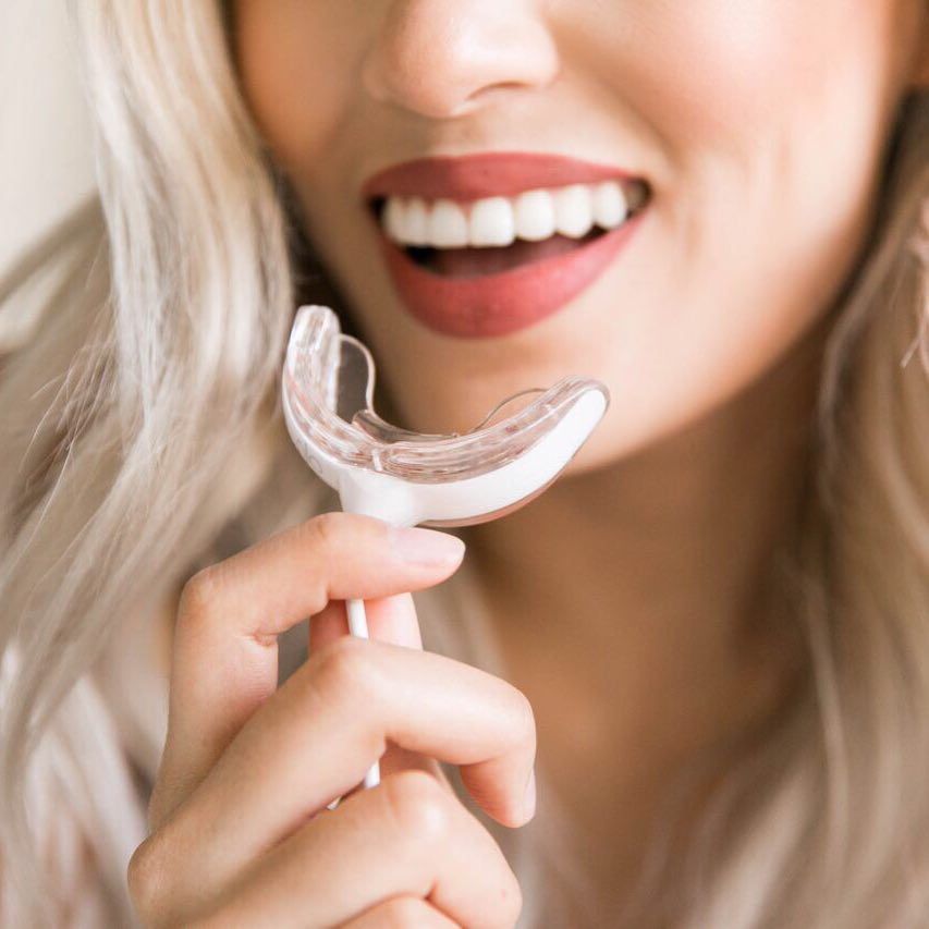 5 loại máy làm trắng răng tốt nhất hiện nay