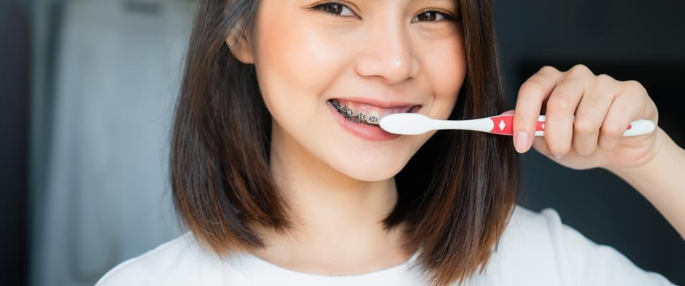 4 Cách Chăm Sóc Răng Miệng Khi Niềng Răng Bạn Nên Biết