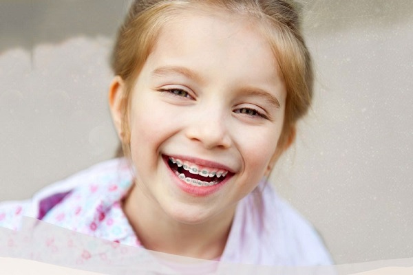 Các phương pháp niềng răng cho trẻ em phổ biến hiện nay - Ảnh 3