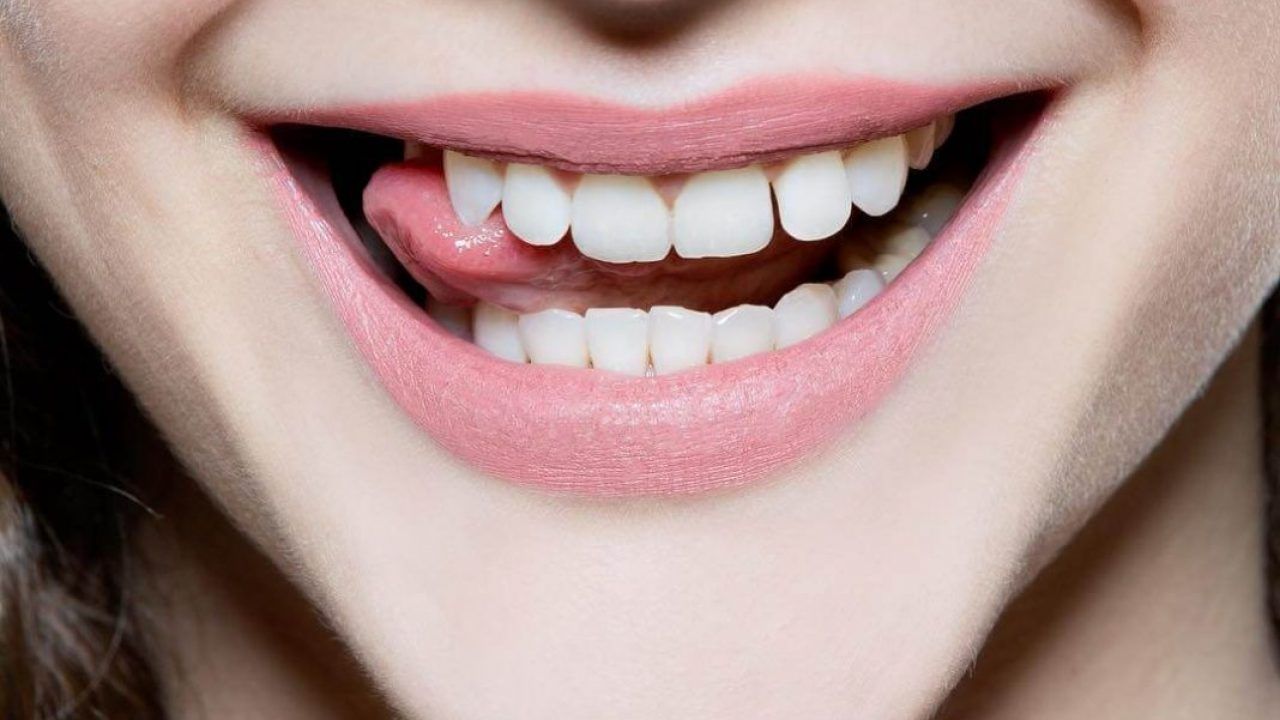 15 cách làm trắng răng tại nhà nhanh nhất cực an toàn