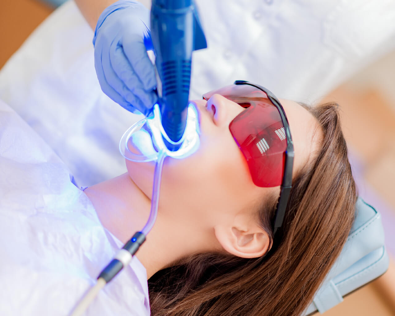 tẩy trắng răng Laser Whitening giá bao nhiêu tiền?