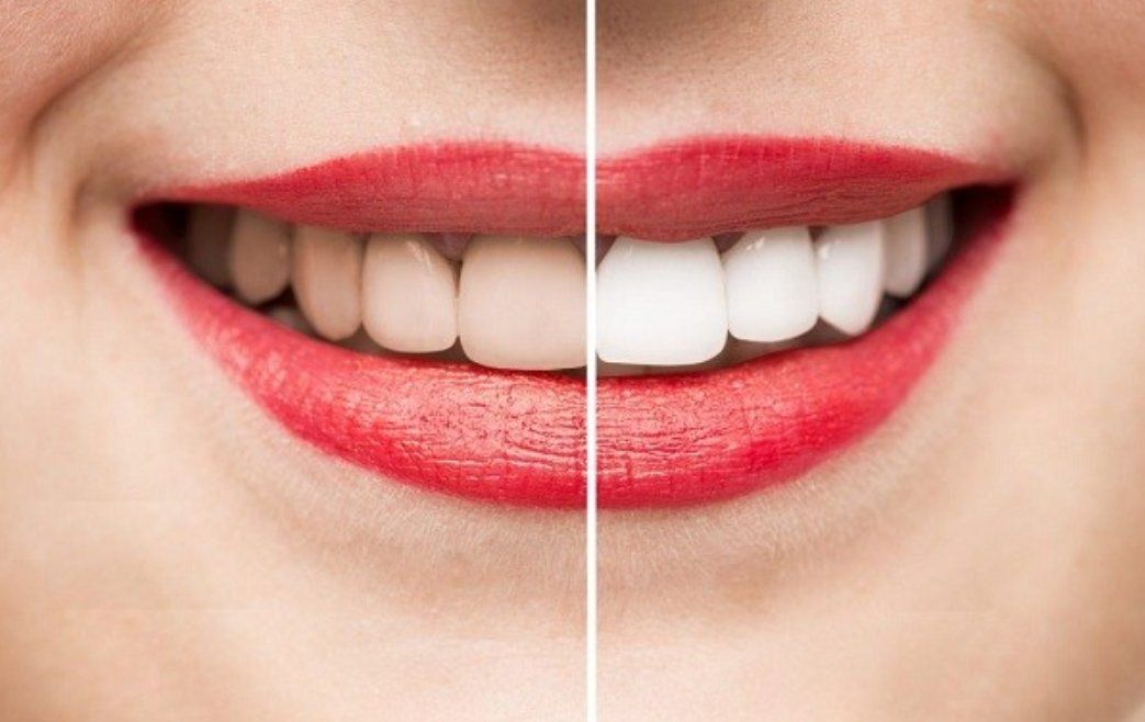 Đâu là tác hại khi sử dụng bột trắng răng sai cách?