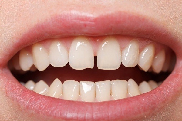 Tình trạng răng miệng của bạn - Ảnh 2