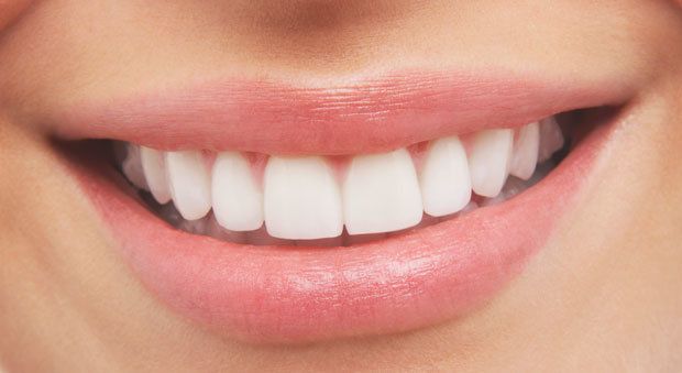 Ngoài thuốc làm trắng răng, bạn còn có thể dùng các biện pháp nào?