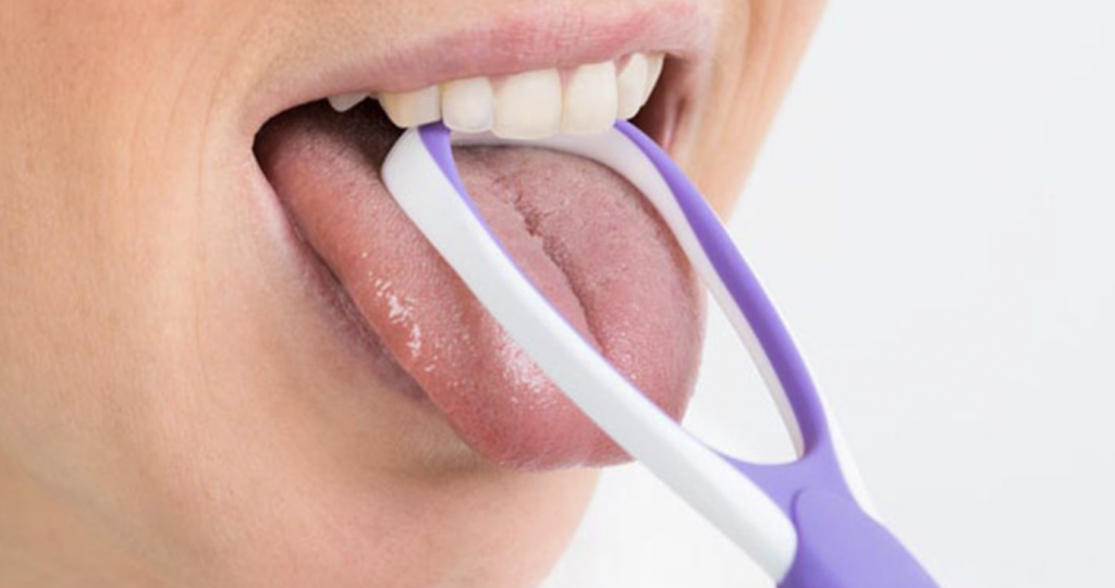 Vệ sinh lưỡi thường xuyên để ngăn ngừa tình trạng lưỡi trắng.