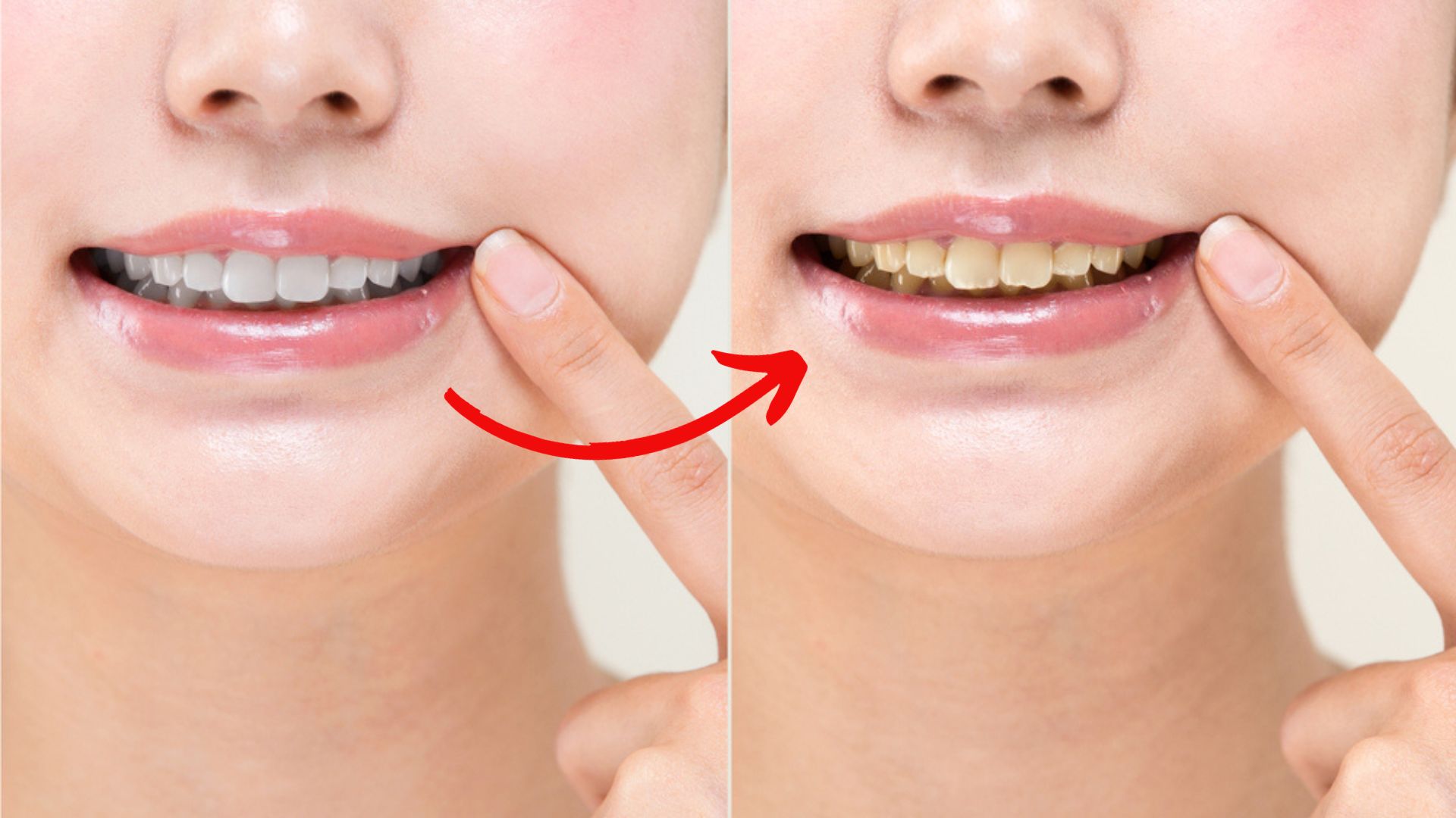 “Điểm mặt” thói quen hàng ngày là nguyên nhân khiến răng bạn bị ố vàng