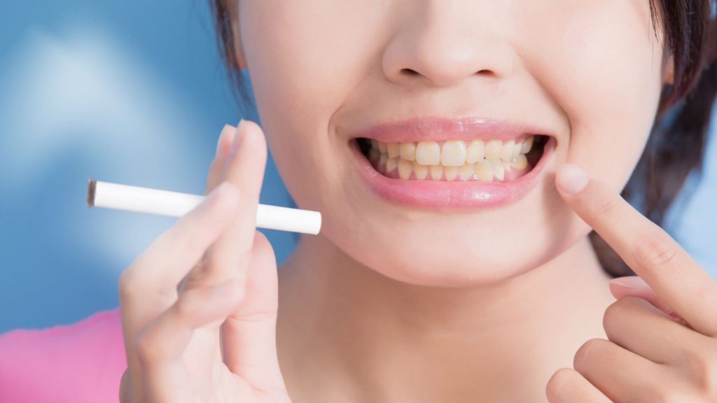 Hút thuốc lá thường xuyên khiến răng bị ố vàng