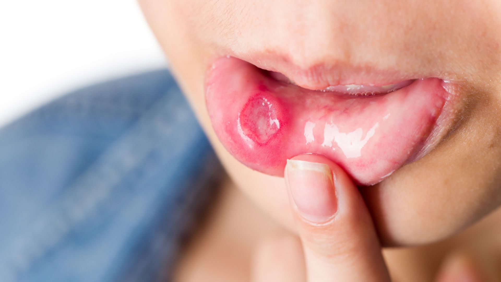 Những tác hại khi không vệ sinh lưỡi thường xuyên