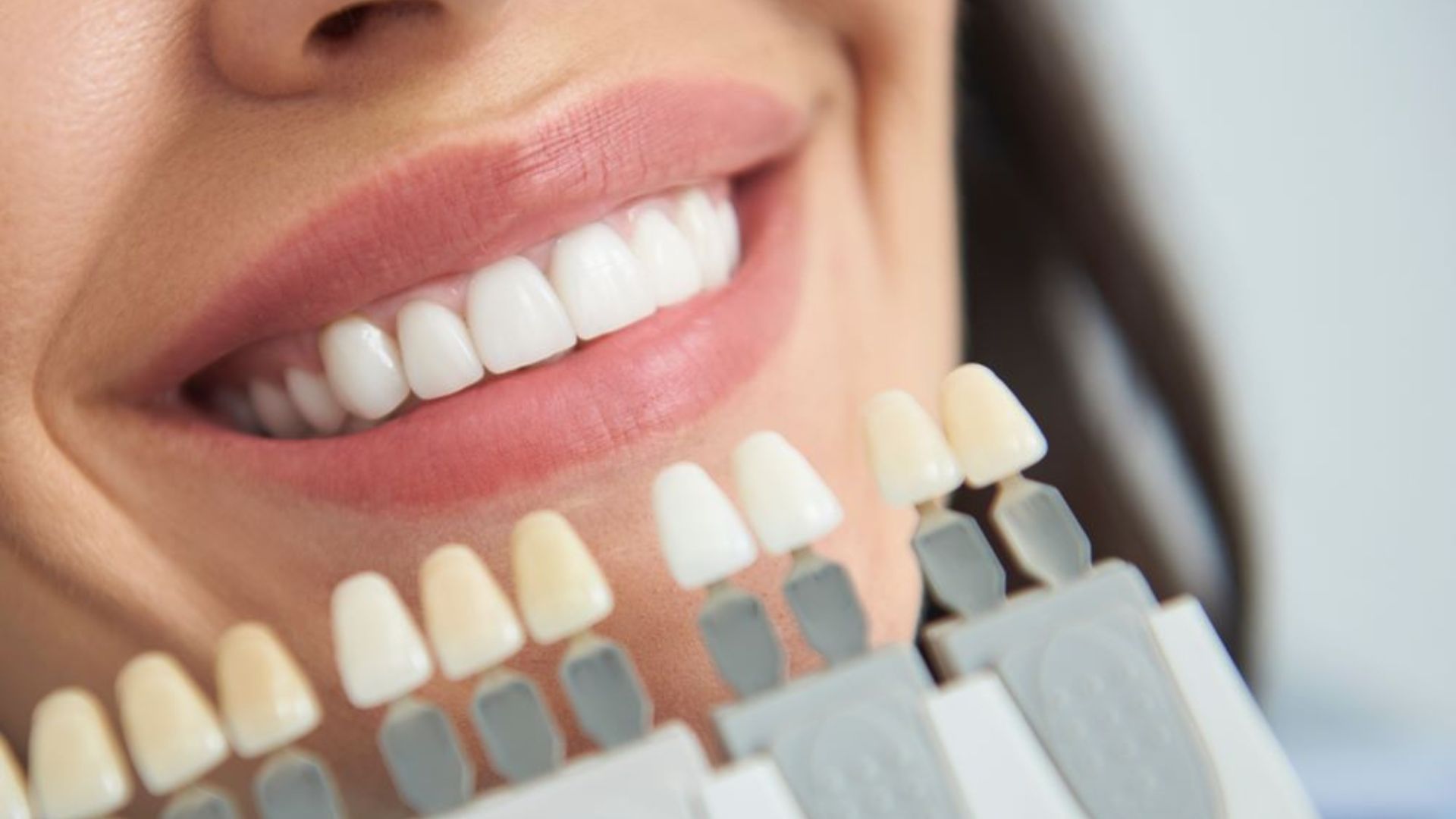 4 Cách làm trắng răng tại nhà hiệu quả và tiết kiệm chi phí