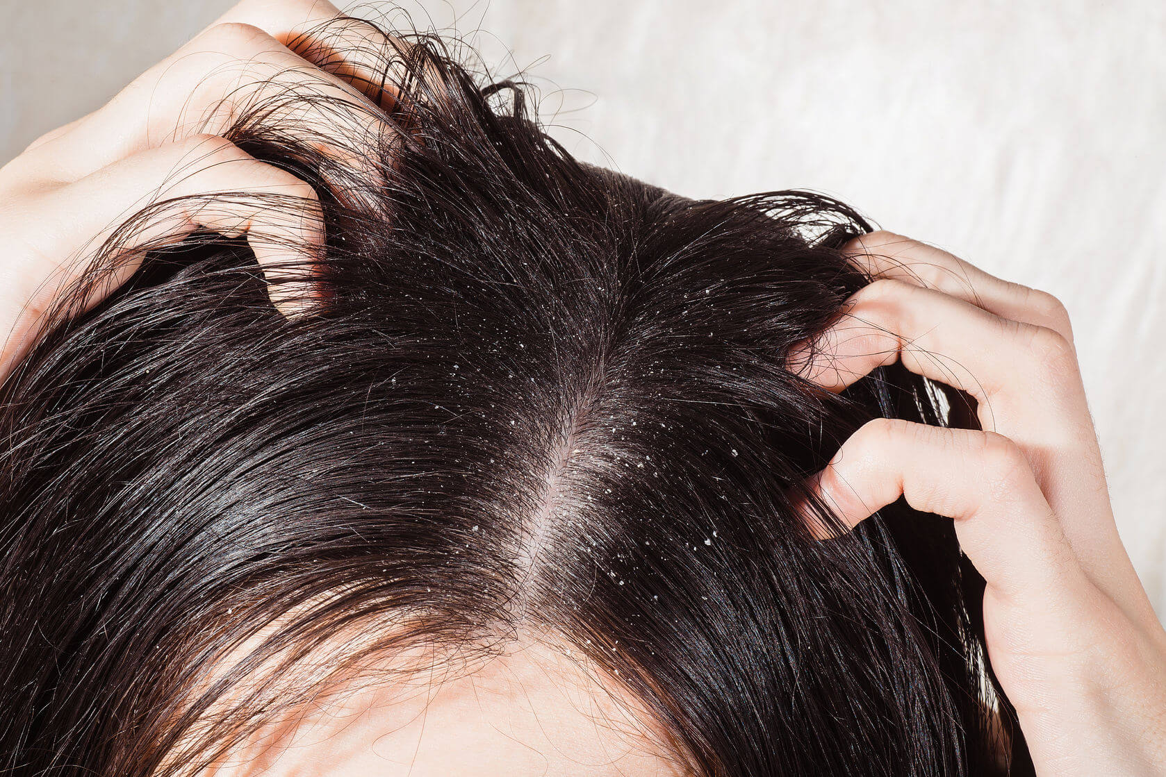 Tìm kiếm sản phẩm trị rụng tóc cho da khô (Nguồn: Internet)