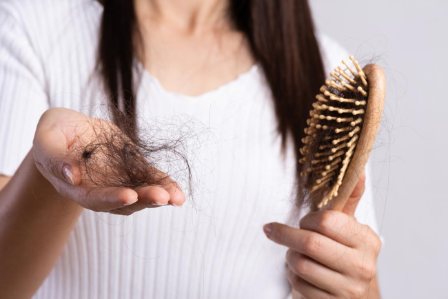 Căng thẳng, lo âu là nguyên nhân rụng tóc thường gặp.